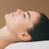 Acupuncture treatment with fine needles inserted into a patient’s back to relieve pain and improve energy flow.